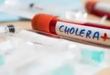 cholera disease