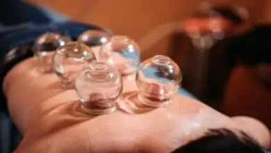 cupping