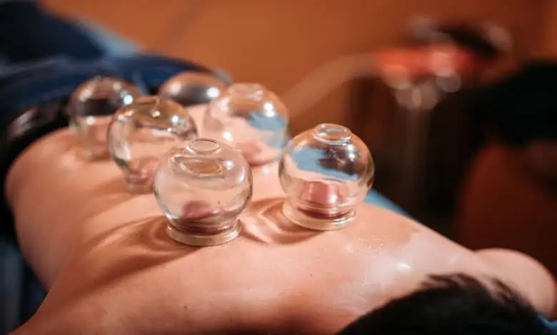 cupping